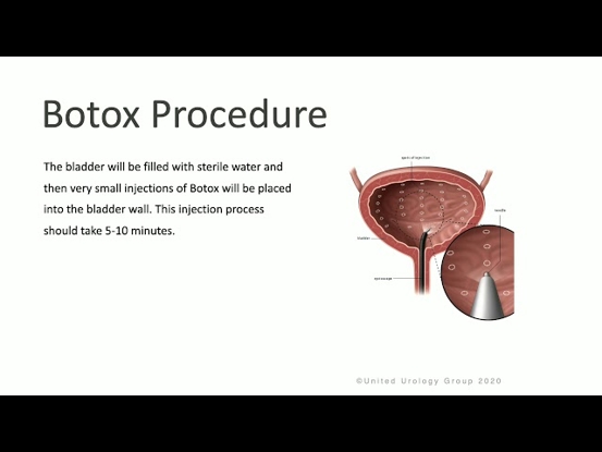 Mid Urethral Sling for Stress Urinary Incontinence in Women | United ...