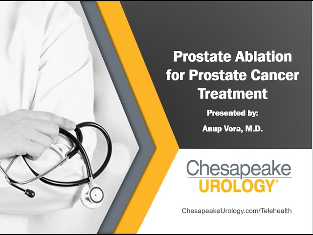 prostate-ablation-therapy-a-non-invasive-treatment-option-for-prostate